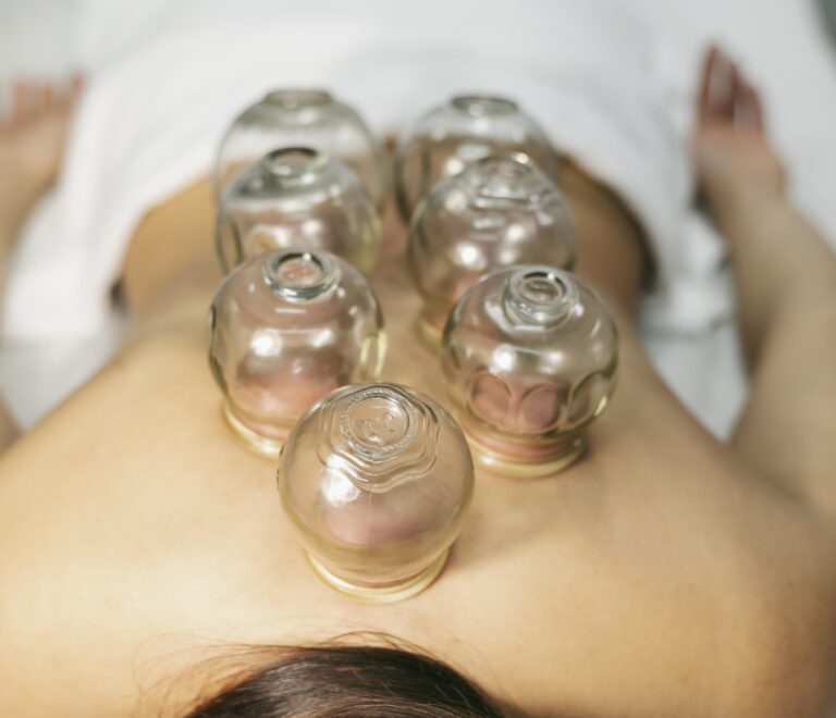 Cupping